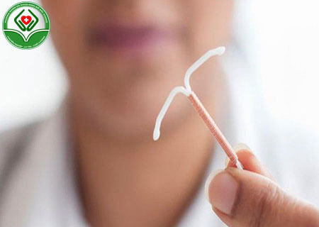 Đặt vòng tránh thai nội tiết như thế nào?