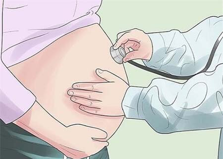 Thai nhi có nguy cơ bị chèn ép nếu thai phụ bi u nang buồng trứng
