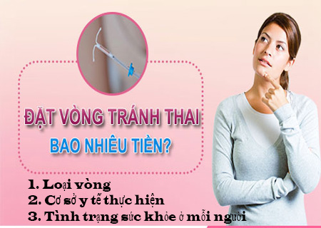 Chi phí đặt vòng phòng tránh thai phụ thuộc vào nhiều yếu tố