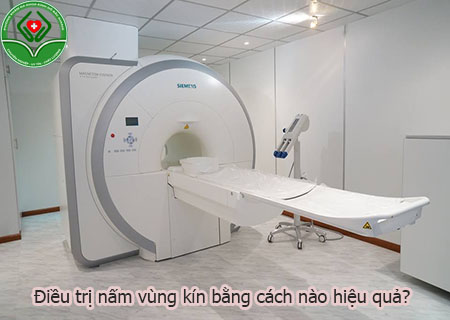 điều trị nấm vùng kín